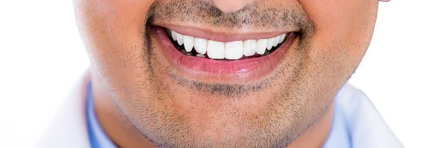 Smile with healthy teeth